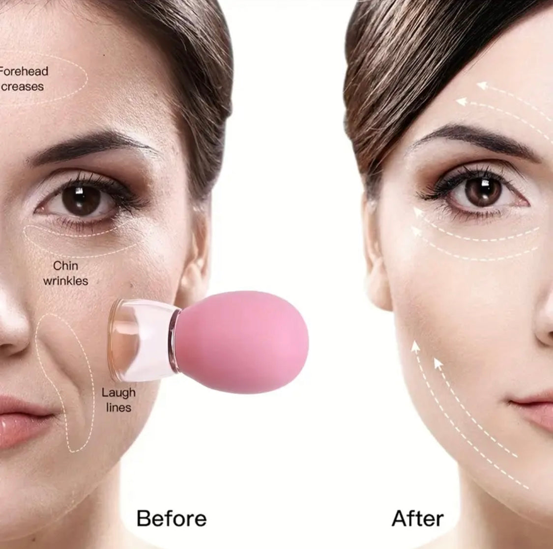 Facial Cupping Glass Cups